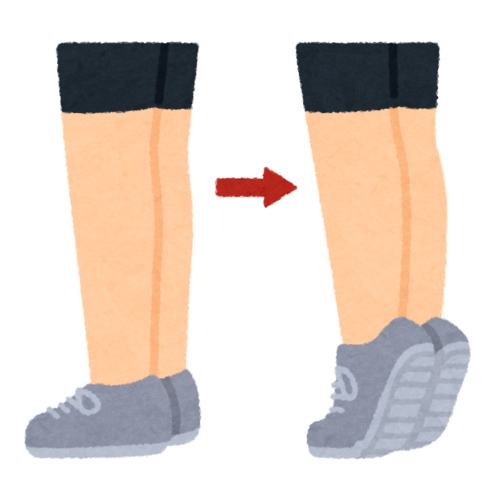 エコノミークラス症候群