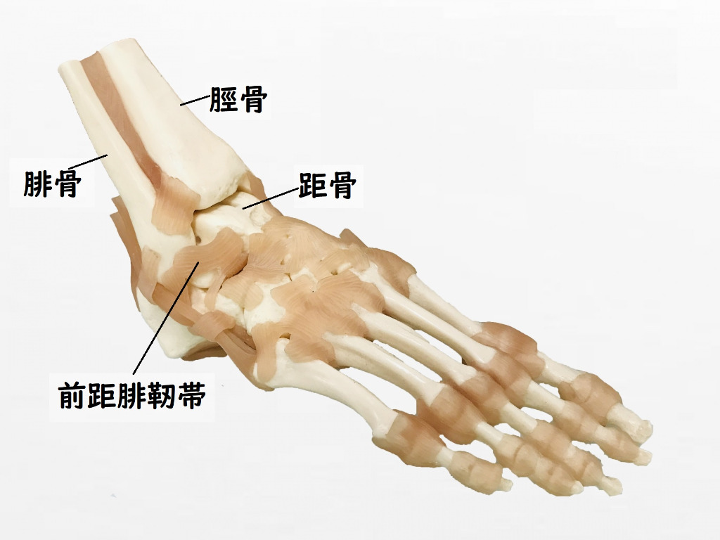 足首の捻挫